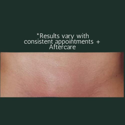 Brazilian Wax (V) 6 Pack at Bare RX + Wellness | Full Body Waxing in Midtown Houston in Houston, TX